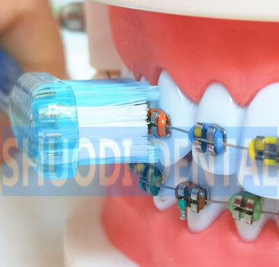 

8 Pcs Orthodontic Braces Teeth Whitening Adult Orthodontic Brushes Dental Tooth Brush U Trim Hard&Soft Toothbrush Deep Clean