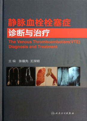 

静脉血栓栓塞症诊断与治疗