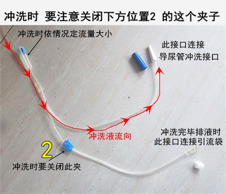 一次性使用膀胱冲洗器腹腔冲洗三腔导尿管膀胱注药连接器冲洗用10个装