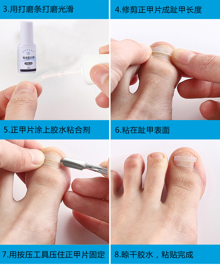灰指甲灰甲净亮甲脱甲膏液甲沟炎专用灰指甲新亮甲1盒升级装
