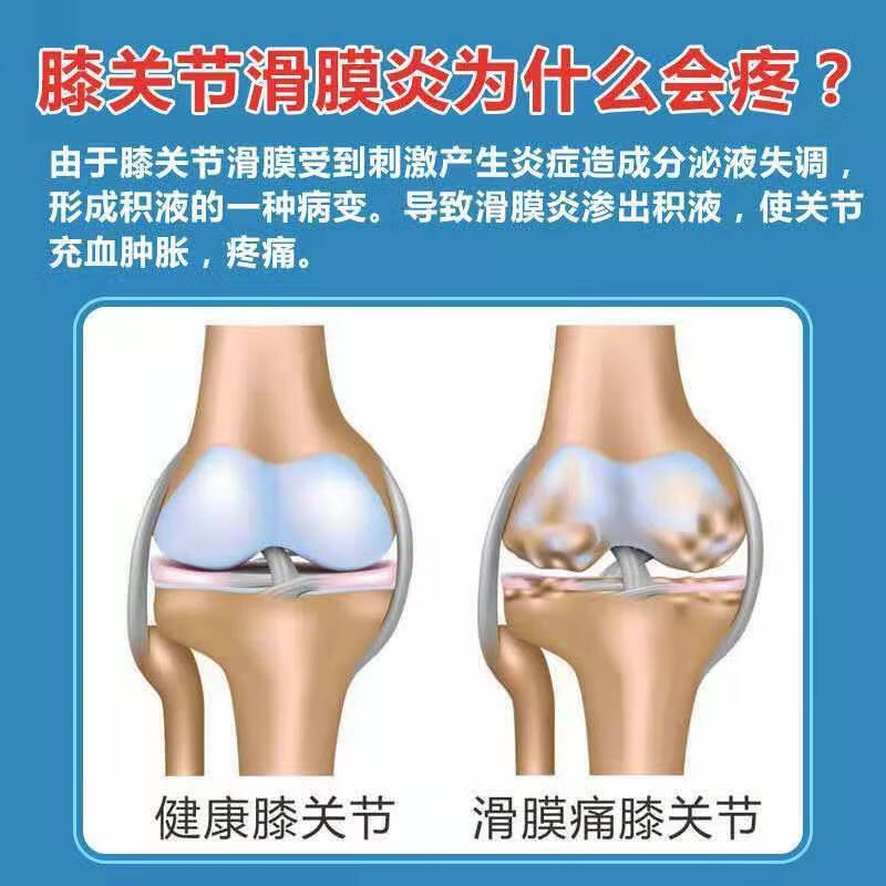 尼坤软膏 华北制滑膜康膏膝盖积水积液软组织损伤膝关节肿胀老寒腿20g