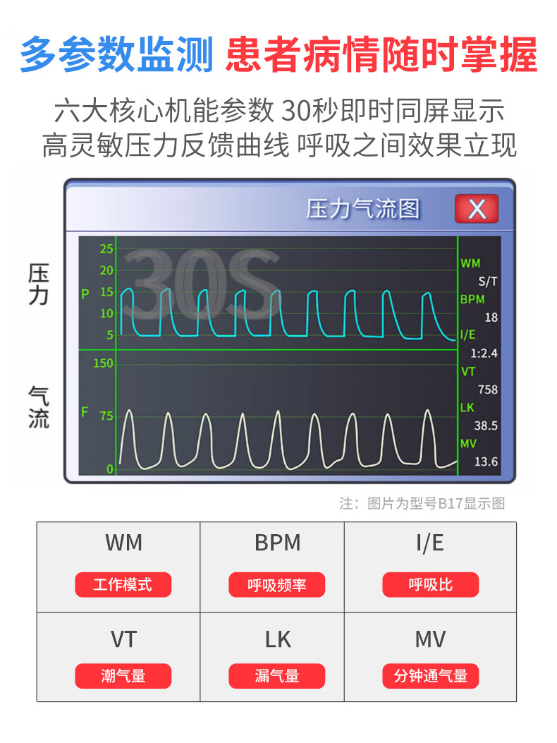 比扬无创呼吸机st模式双水平呼吸机家用老人睡眠呼吸机慢阻肺copd排