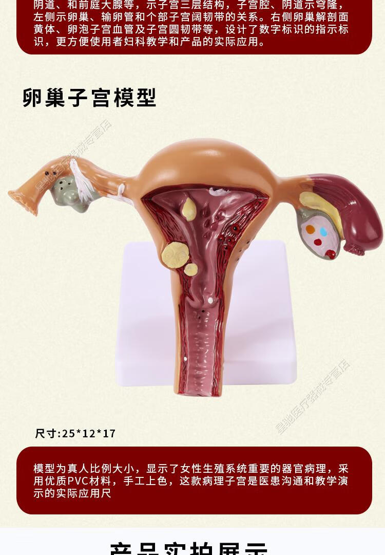 人体子宫附件模型女性医学生殖器卵巢病理病变结构解剖教学具娇之乐