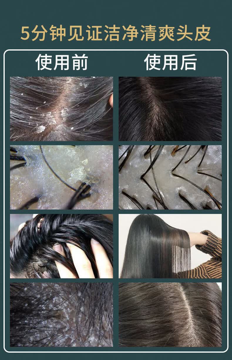 官方旗舰毛囊堵塞疏通头皮清洁凝露护发l素新珐丰润防l脱干枯头发护理