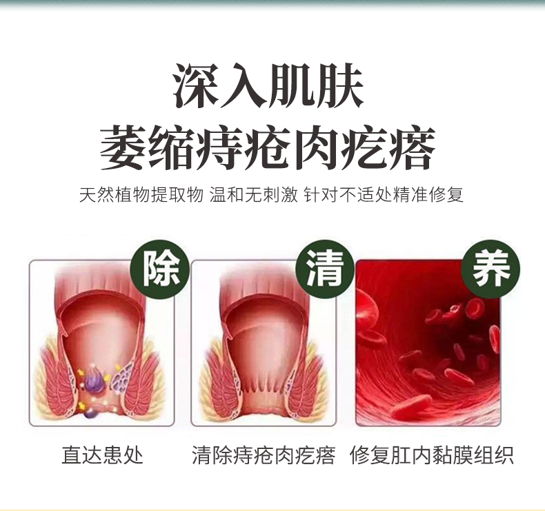 过年不打烊顺丰快递发货芙草堂冰幨抑菌凝胶内外混合型痔l疮便血栓肖