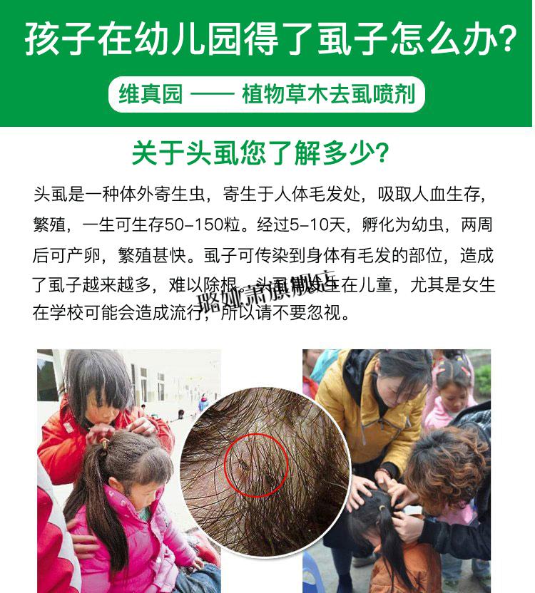 头上长虱子的药 虱子药儿童头虱虱子药小女孩头发虱立净去除虱卵儿童