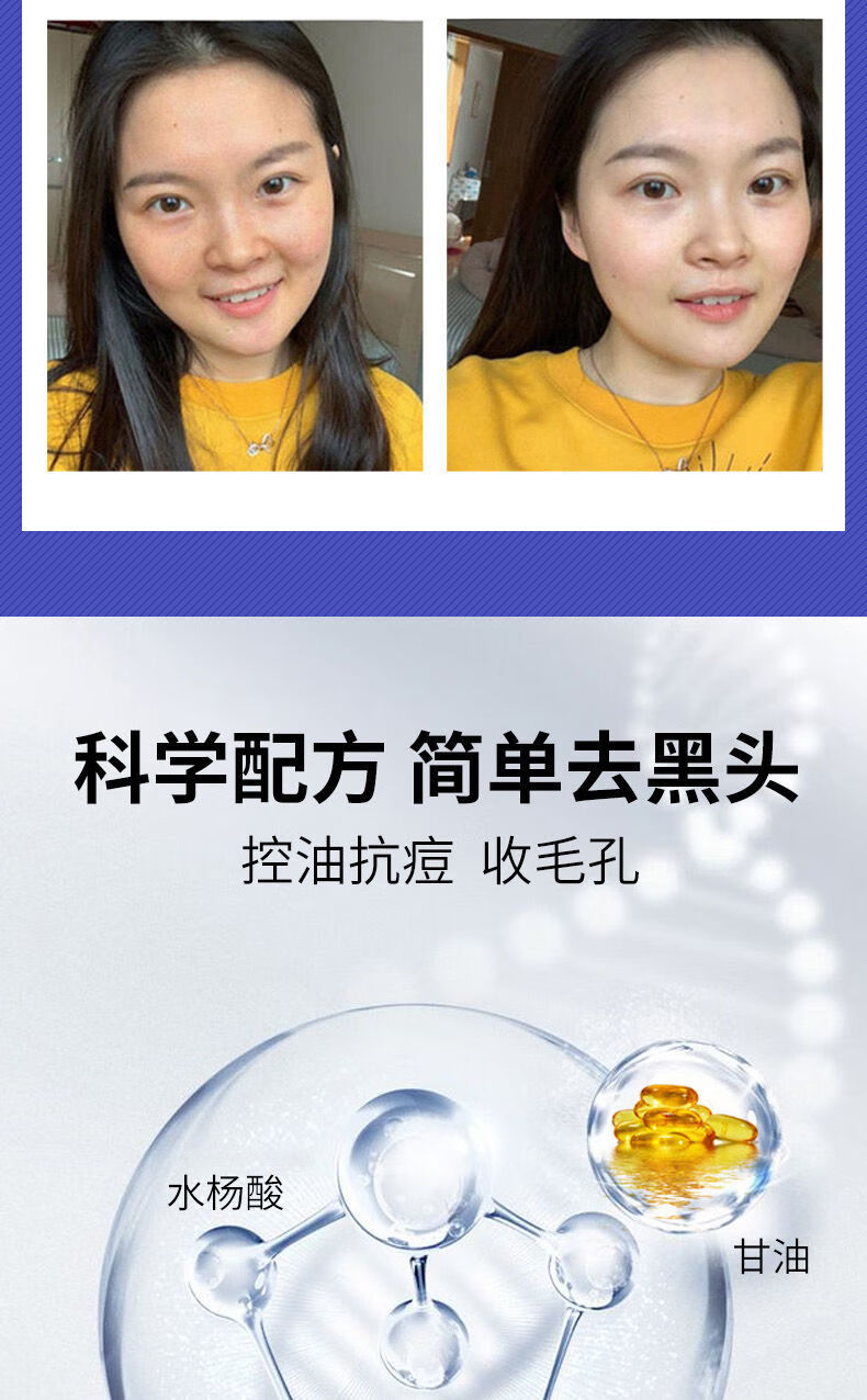 华南理工大学研发洗面奶韩鹭洗面奶水杨酸控油去豆洗面奶华南理工大学