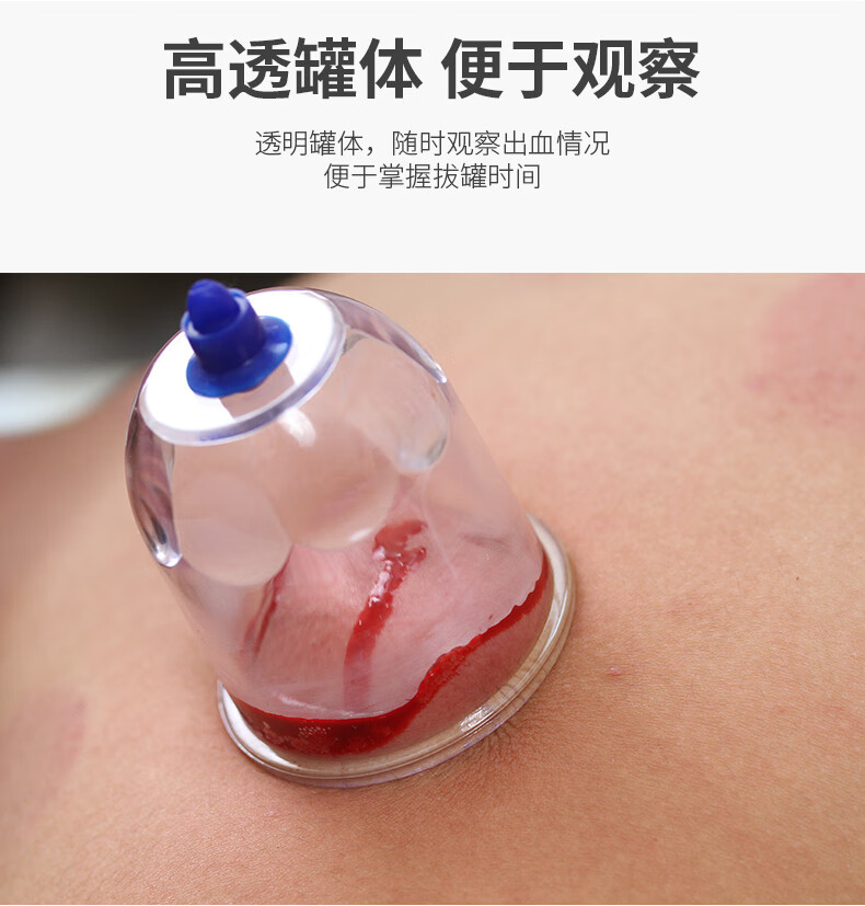 泻血刺络放血罐真空拔罐器家用抽气式气罐心天排淤拔血罐排瘀罐 7号小