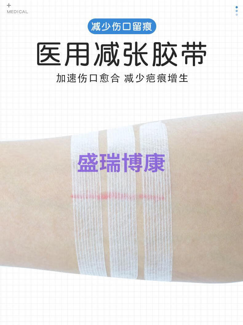 医用免缝剖腹产术后皮肤伤口拉合减张胶布贴疤痕增生 12*100mm【1袋
