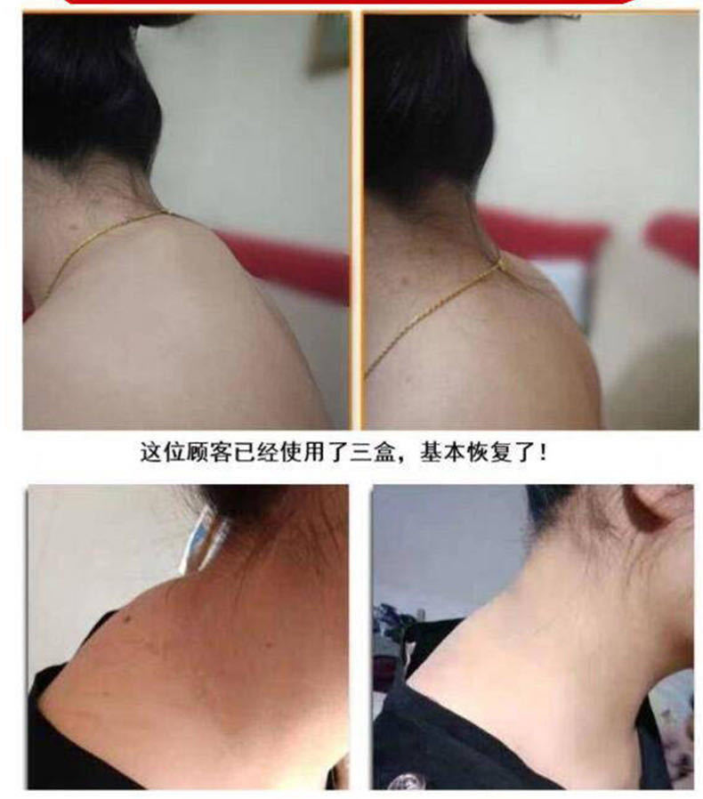 艾草颈椎贴只要富贵不要包专用疏通鼓包淤堵痛 【】消除膏1盒【图片