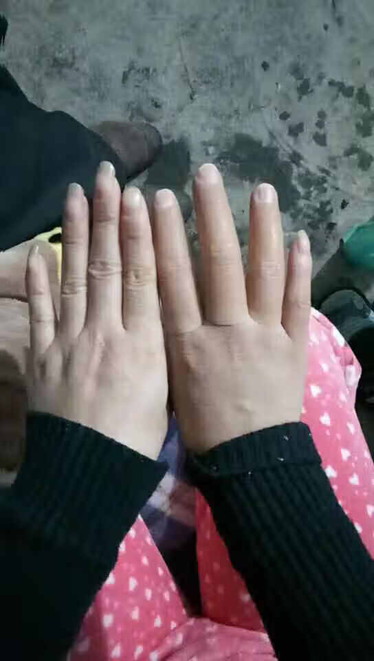 升级新款假肢假手指仿真指套美甲半指脚趾套进口硅胶美容手指套残疾人