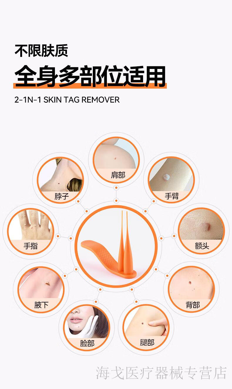 60jd健康60去除脖子上长的瘊子小肉粒疙瘩专用肉痣肉刺祛疣体丝状