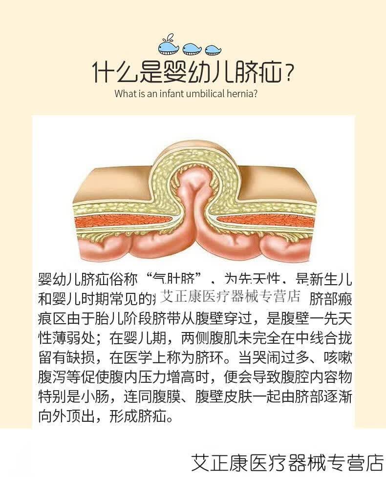 手掌型脐疝带新生婴儿型护脐带宝宝压脐疝袋包凸肚脐贴医用透疝气普通