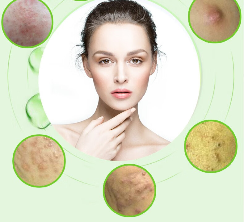 好脸面爽肤控油洁面乳男女去痘痘深层清清洁毛孔洗面奶康采好脸面爽肤