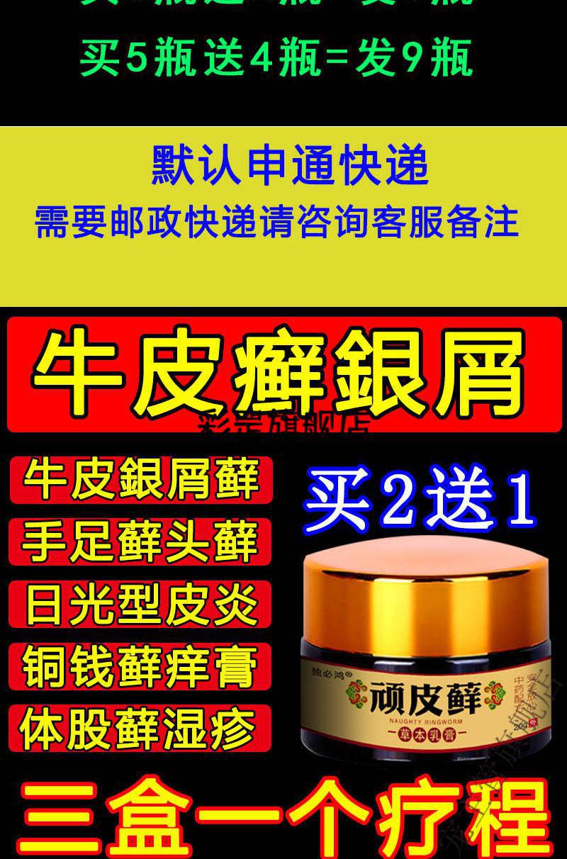 复方黄柏祛l癣搽剂治l疗牛l皮l癣银l屑l病瘙痒止l痒湿l疹去l根体l股l