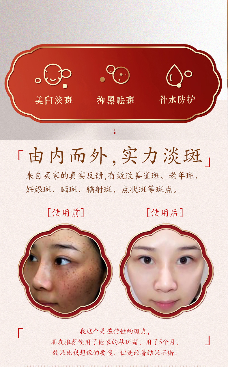 青春期祛斑方法_青春期雀斑能自己消除吗_青春期祛斑