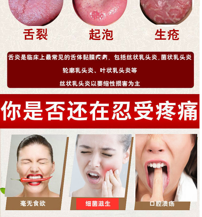 dj好物48种顽固苔癣起泡烂嘴疮扁平裂纹舌舌炎地图舌烂舌头黑舌痛肿胀