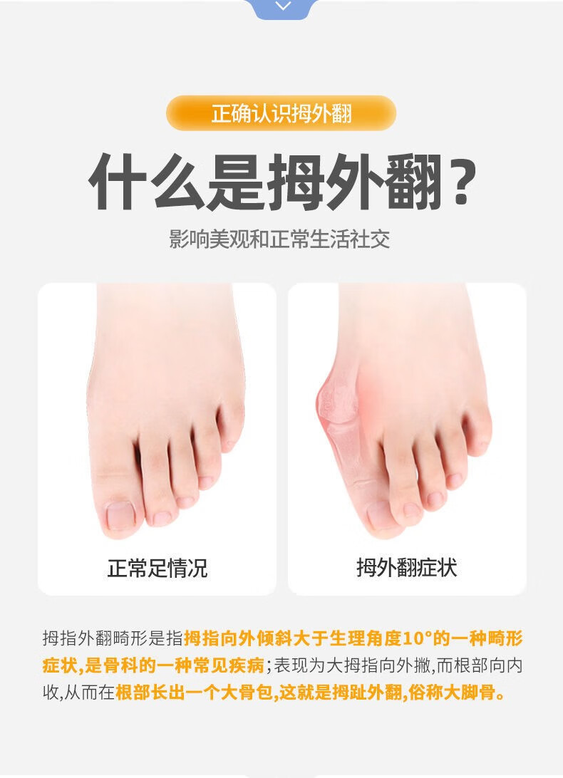 拇外翻器脚趾外翻大拇指外翻内翻大脚骨足外翻脚趾重叠器 1只夜用款
