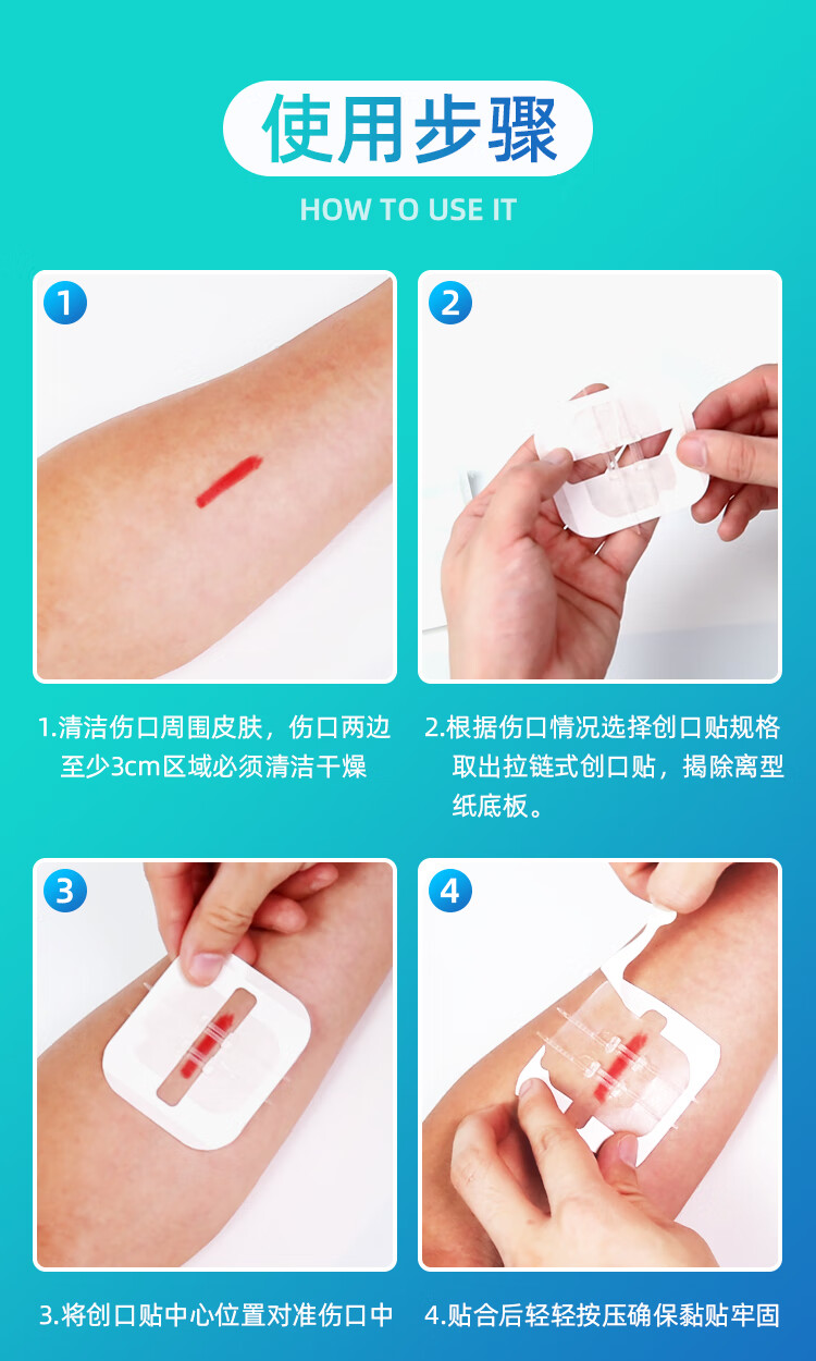 减张器拉链式创口贴医用皮肤疤痕减张贴儿童成人张力贴刨腹产术后减