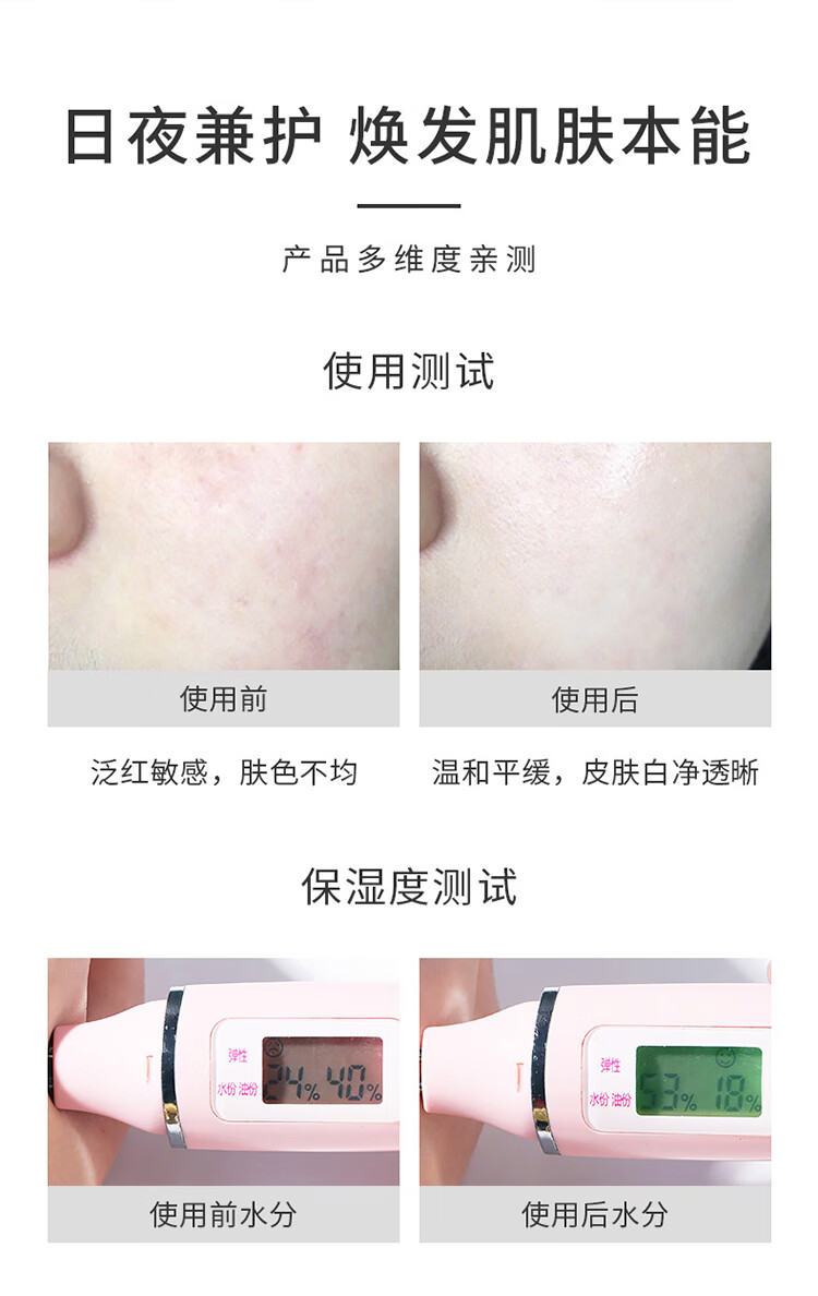 ahc紫苏水乳套装护肤品保湿补水学生油皮痘肌敏感干皮女清爽水乳套盒