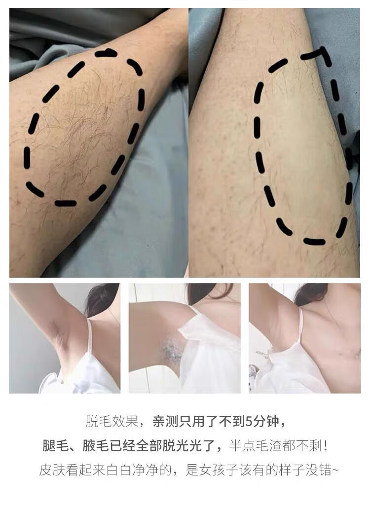 水之蔻脱毛膏女专用去腋毛腿毛男士学生温和腋下 30克【图片 价格