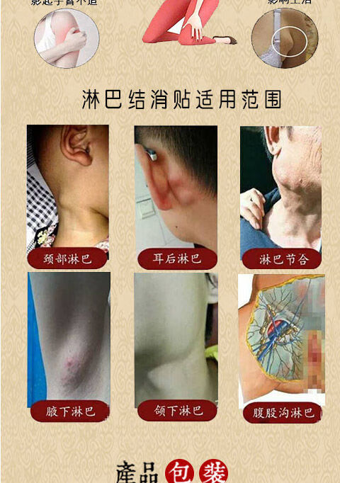 副乳贴淋巴贴颈部腋下淋巴通络贴结节肿大淋巴贴散结疏通结节12贴1盒