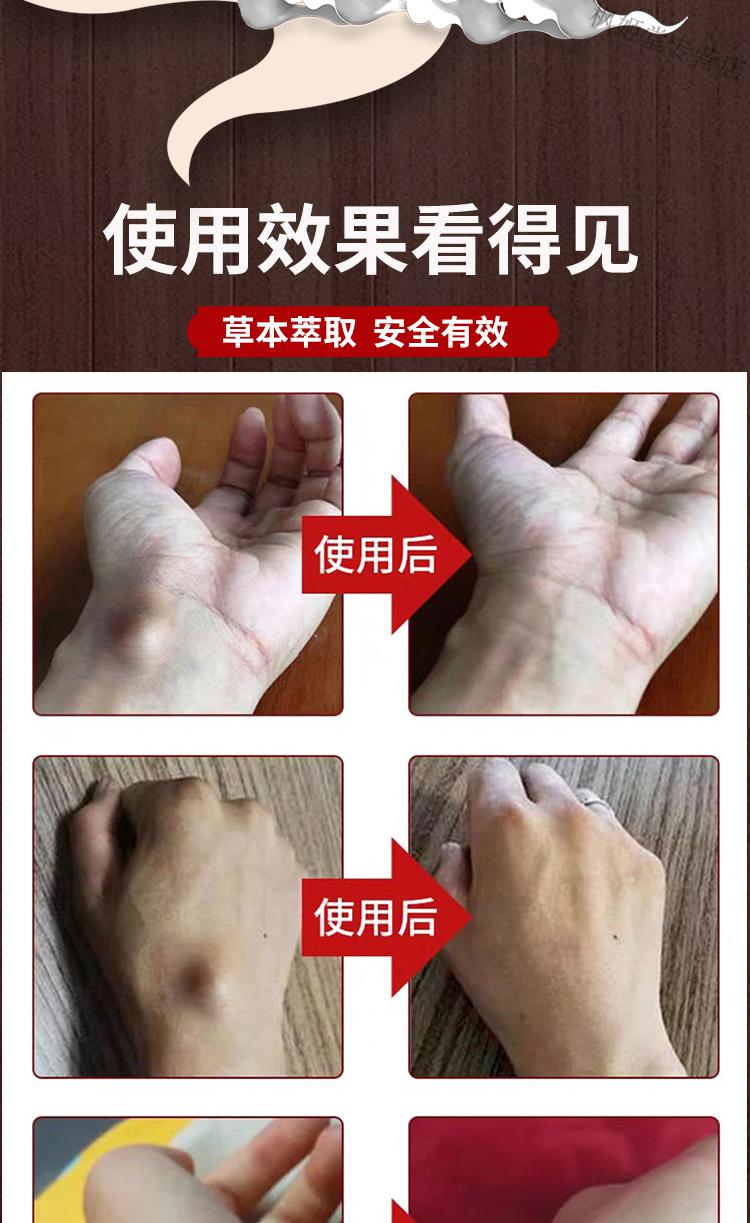 【顺丰直邮】云泰祥立牌柯瑞森六号腱鞘焱冷敷凝胶黑盒6号官方 三盒装