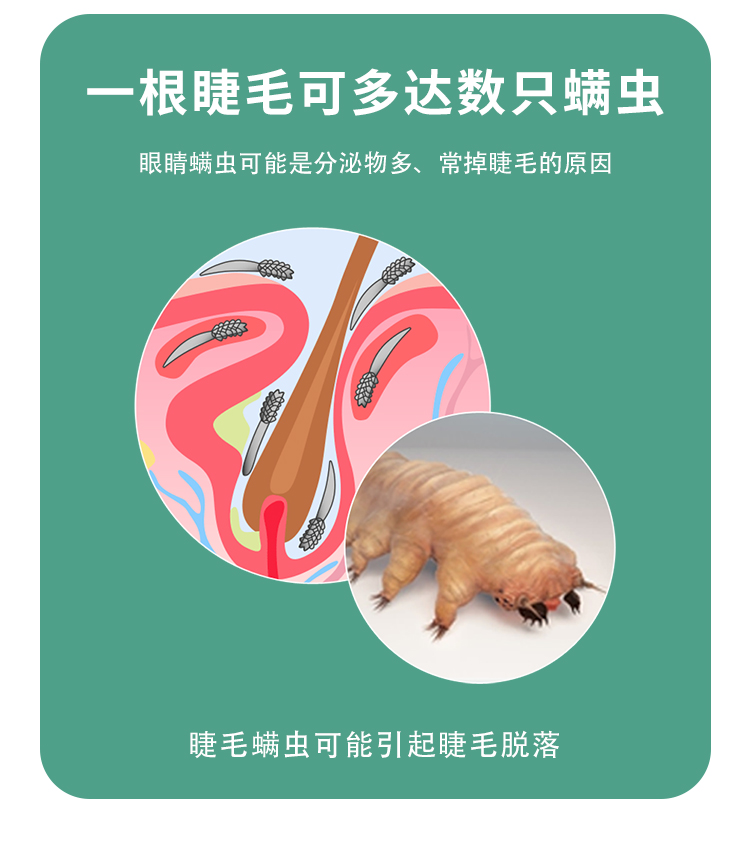 茶树精油眼部清洁除螨湿巾四4松油醇棉片眼贴眼睛睫毛螨虫缓解眼干