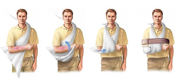 jd健康医用包扎三角绷带带带子9696136超厚加大纯棉布医院医用三角巾