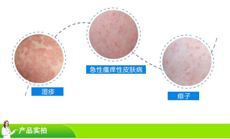 信龙炉甘石洗剂100ml婴儿湿疹皮炎祛痱止痒洗剂1瓶装
