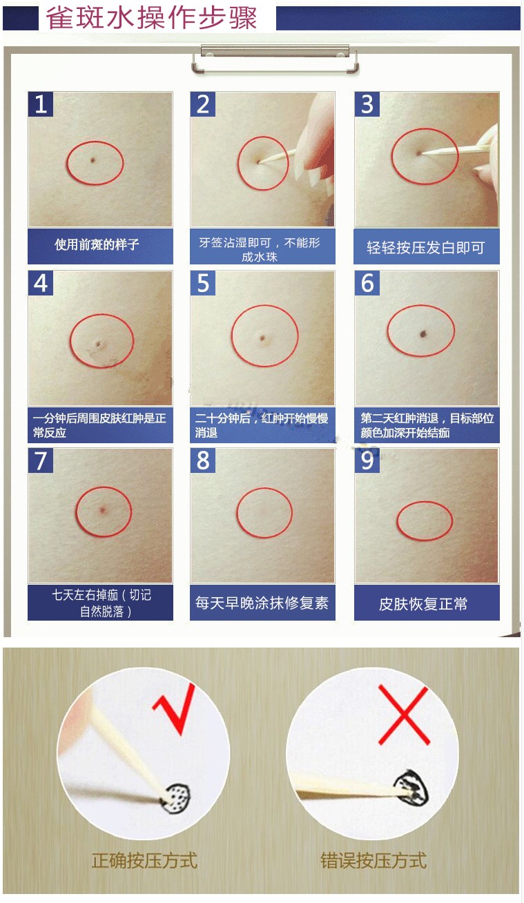 点蝇子屎点斑水无痛美容金水雀斑净点斑水点斑水黑点春水雀斑净春水堂