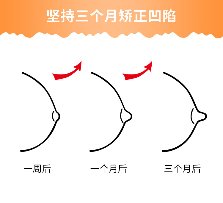 乳头乳头内陷器凹陷短小扁平纠正器心惟佳女性乳头