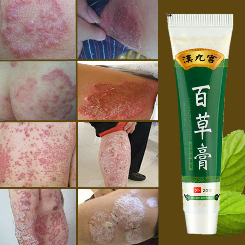 汉九宫百草膏皮肤瘙痒外用过敏肛门肛周潮湿屁眼痒止痒膏1盒体验装
