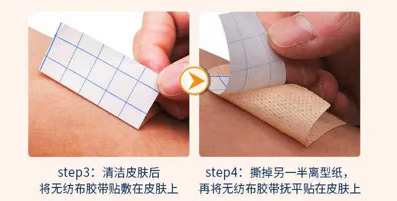 鼻饲管鼻贴导管固定胃管固定鼻贴加压固定胶带 肤色弹性胶布10cm*5m一