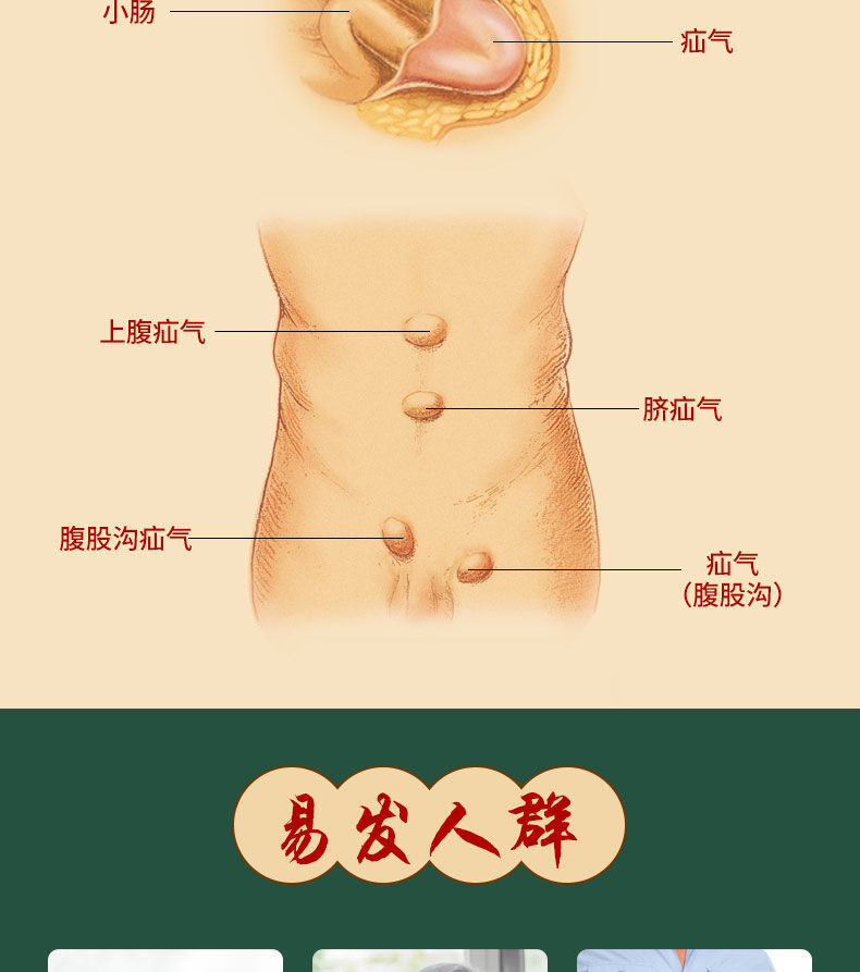 【200%当天消】疝气贴腹股沟疝气小肠疝气气肿胀中老年成人小儿脐疝