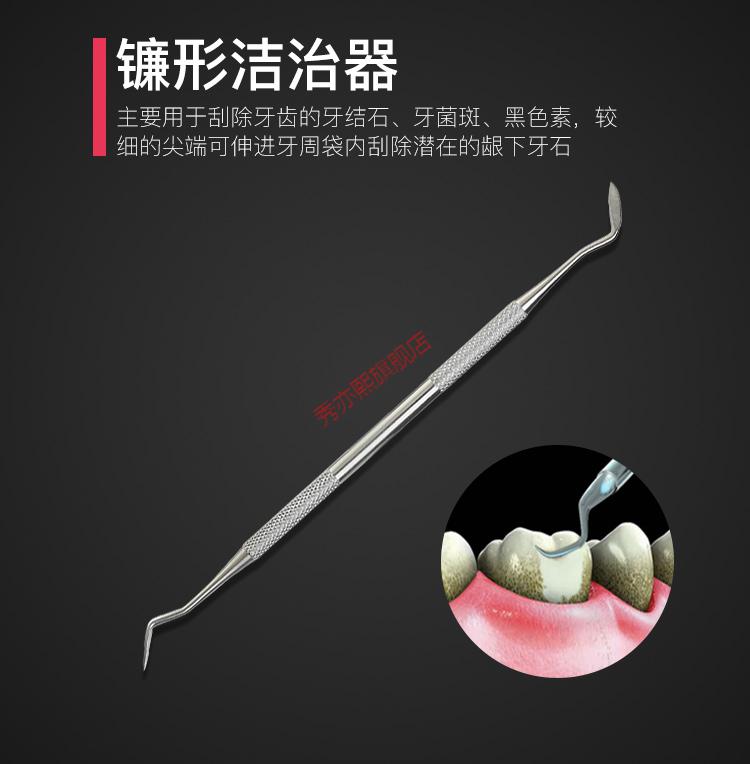 不锈钢工具材料口腔镜家用去除牙结石牙渍看牙齿清洁剔牙神器镰形器