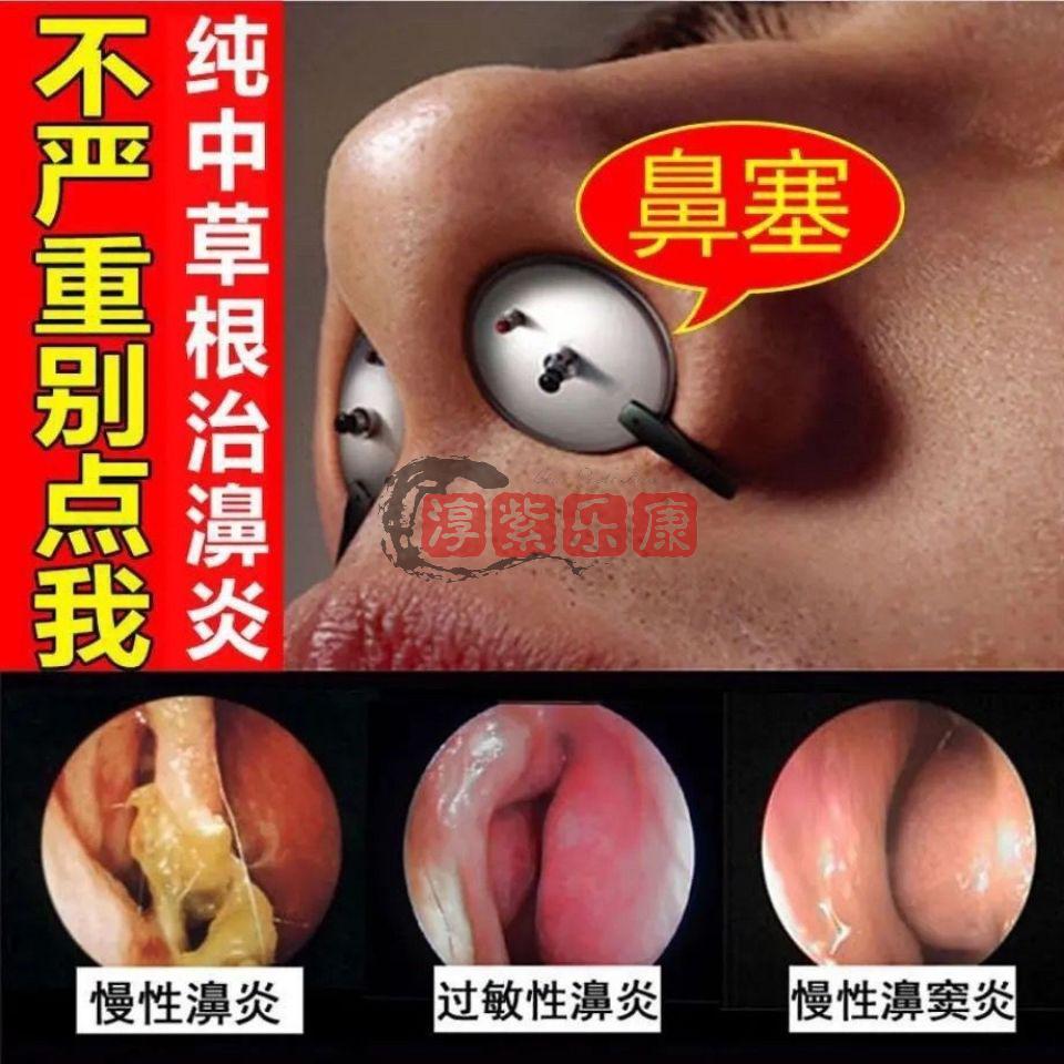 鼻炎贴鼻过敏性鼻炎嗅觉减退头昏记忆力减退一盒6贴体验装鼻炎贴