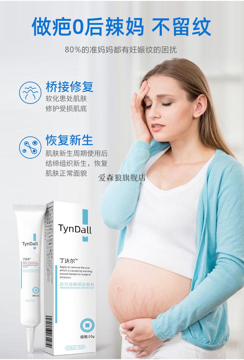 助迈丁达尔修复膏淡纹膏产后淡化霜去肥胖纹生长纹消除大腿学生女士