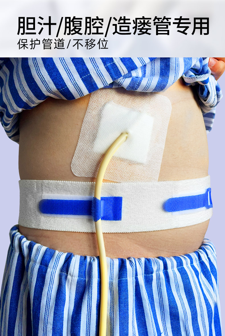 体表导管固定腰带保护绑带造瘘管胸腔腹腔胆汁引流尿袋导管固定贴升级