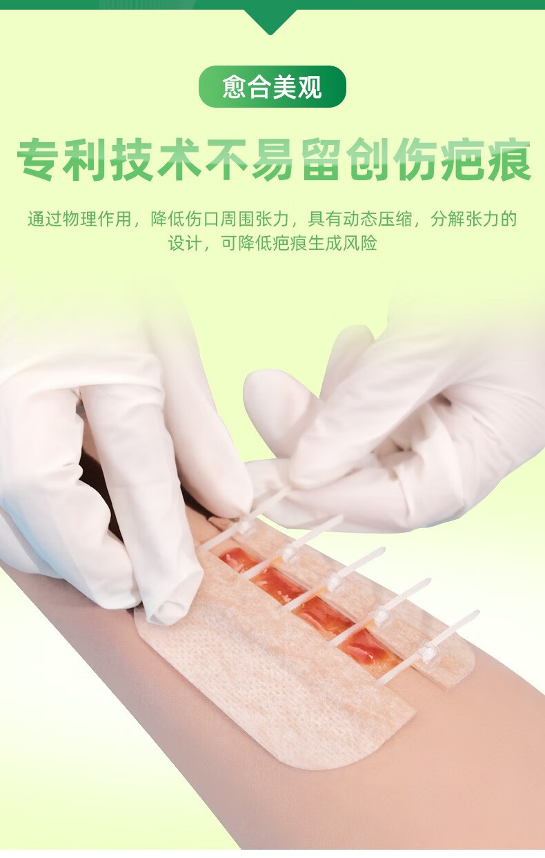 免缝合伤口贴拉链创可贴无痛缝合贴免缝针创口贴减张贴减张器伤口缝合