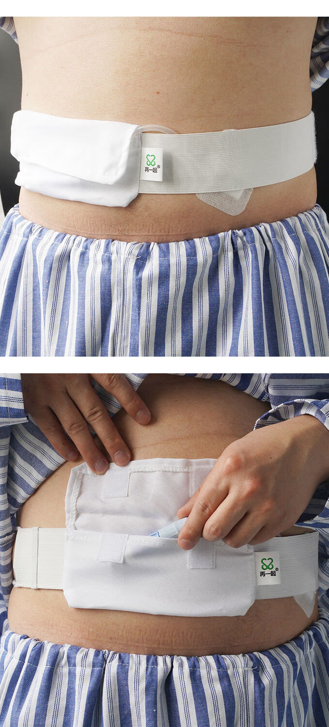 腹透腰带腹透导管固定管路保护带腹膜透析用品夏季白色纯棉透气 2条 1