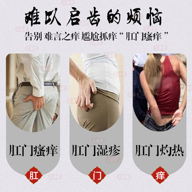 肛痒灵肛门私处瘙痒止痒肛周潮湿奇痒男女通用