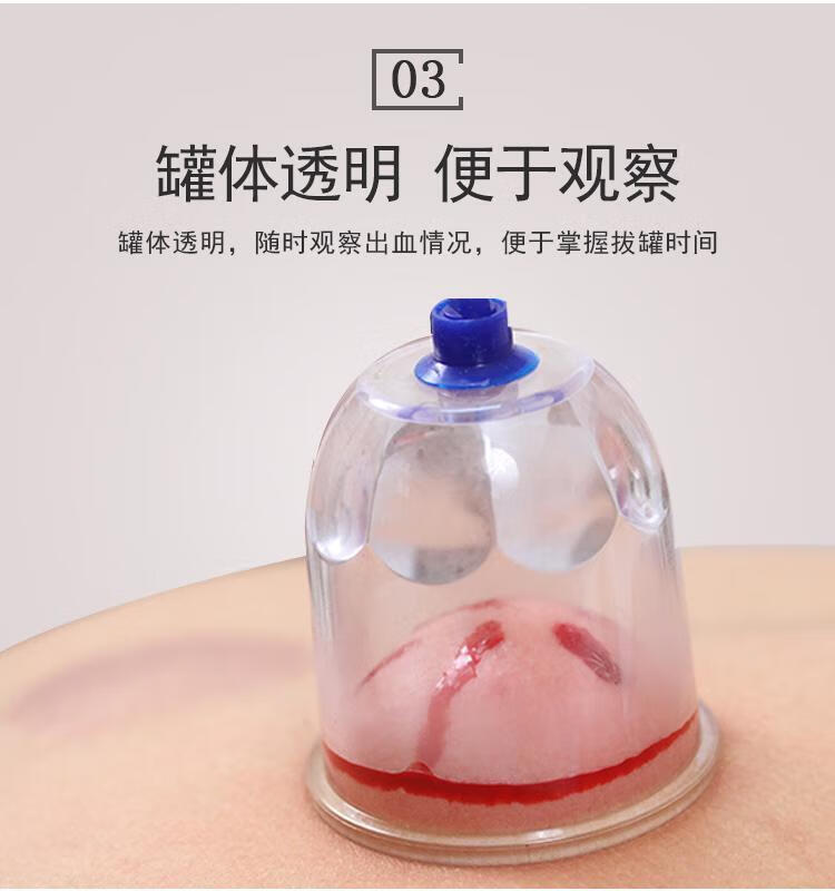 岙筱放血罐单个真空拔罐器家用抽气式气罐心天排淤拔血罐泻血排瘀套装