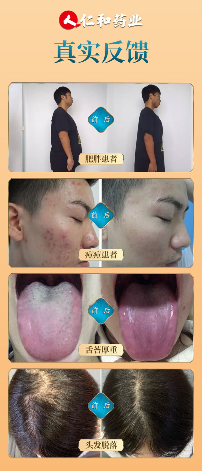 仁和珍百草橘皮薏米芡实茶红豆芡实赤小豆茶气养生茶包5盒巩固装买三