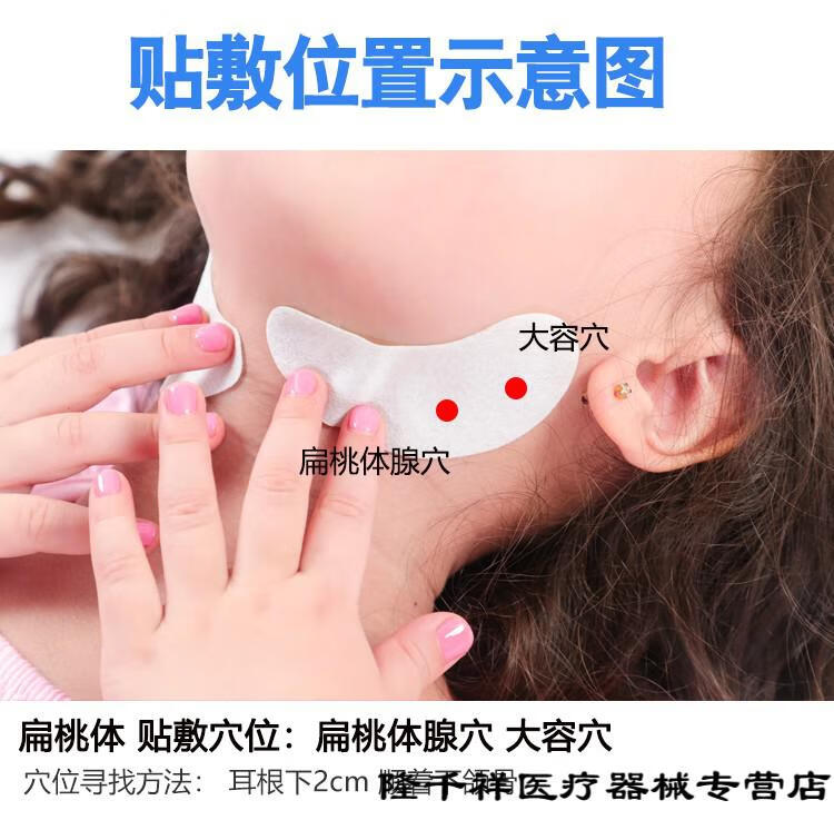 咽扁贴儿童扁桃体肥大肿大发炎贴结石咽喉肿痛小儿扁桃体贴一盒装