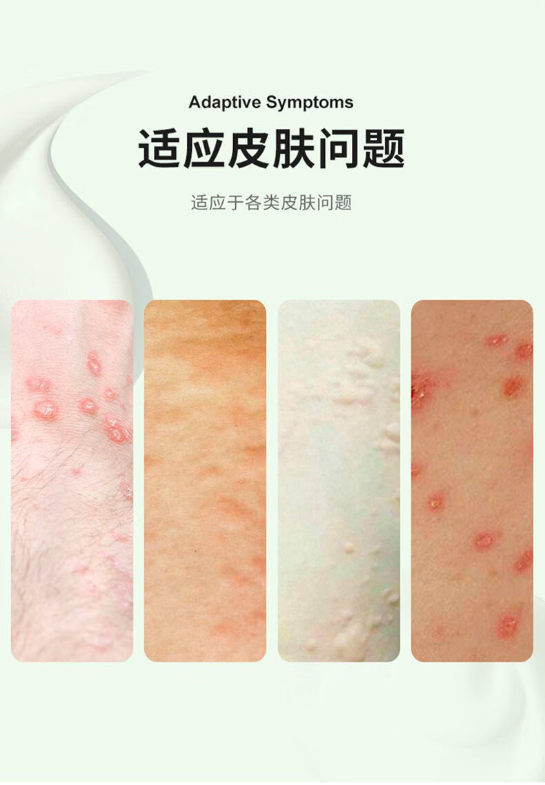 外用乳膏含5硫磺复方阴虱皮肤螨虫脂溢性头螨疥虫膏硫磺软膏买一宋一2
