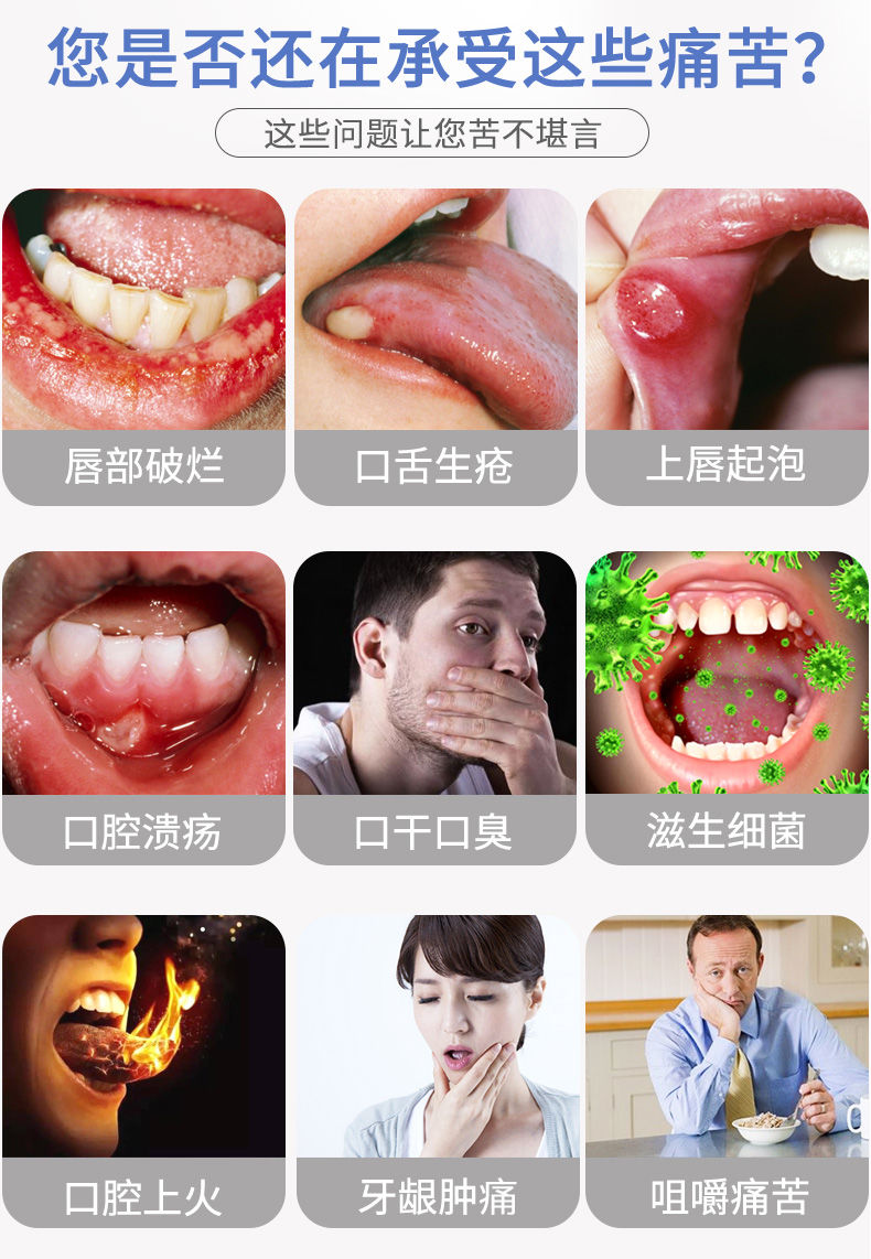 口腔溃疡喷剂口疮箹溃烂气泡上火嘴巴舌头起泡口腔上火生疮抑l菌液