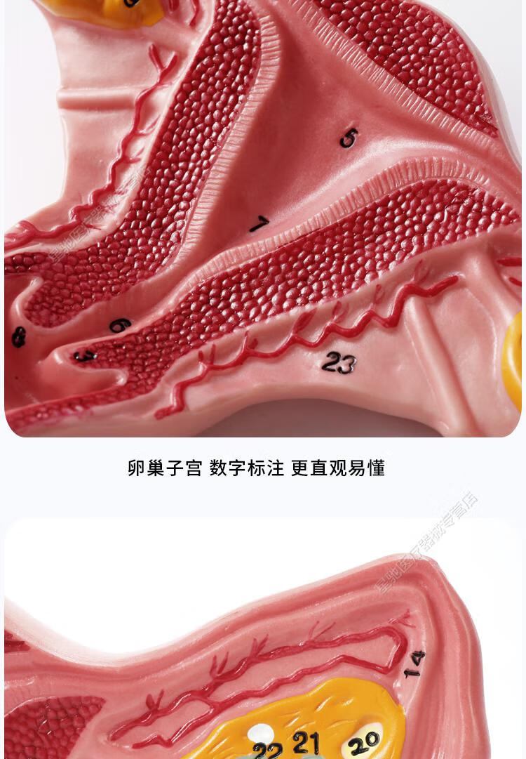 人体子宫附件模型女性医学生殖器卵巢病理病变结构解剖教学具娇之乐