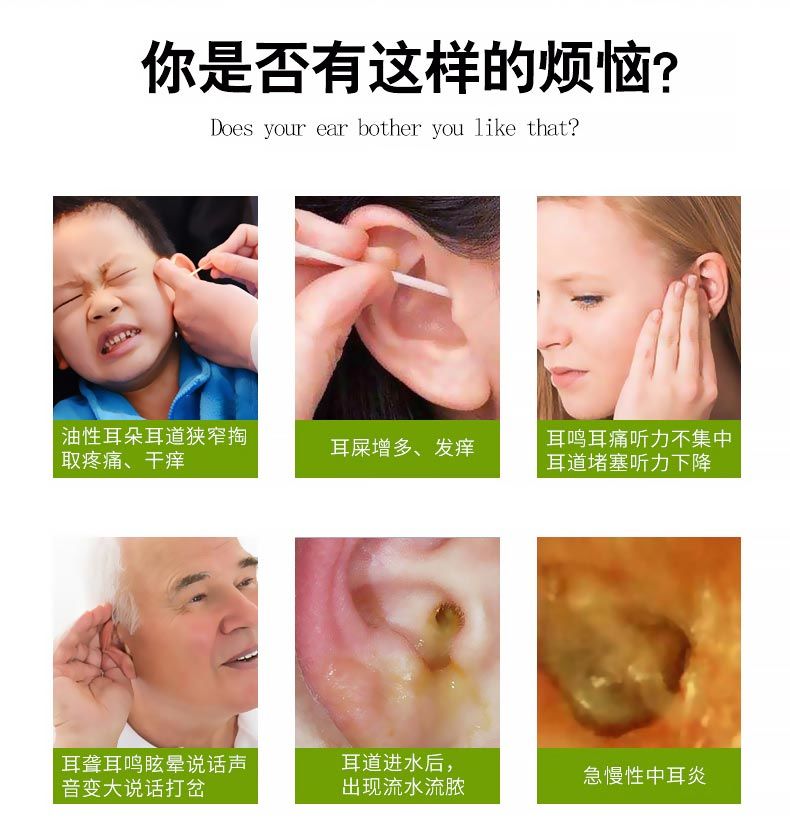中耳炎药耳康滴耳液人用耳朵痒耳屎软化耳聋耳鸣药神经性耳响 1盒耳康