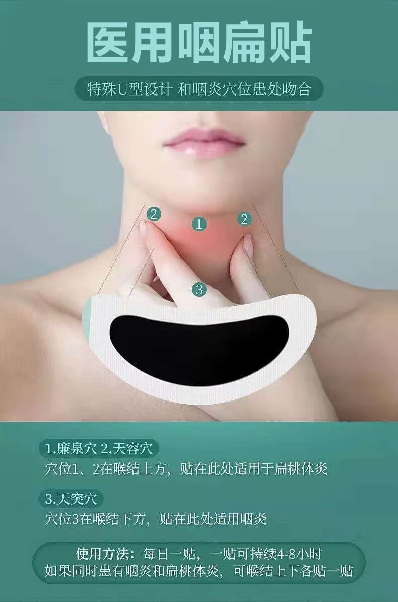 反流性咽炎干痒嘶哑咳嗽咽喉肿痛发音困难嗓子有异物感咽扁炎贴5盒